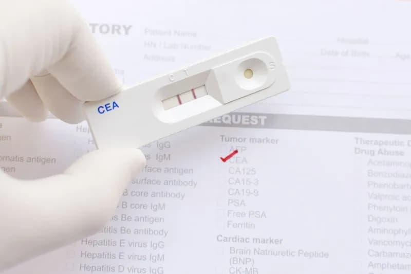 Co oznacza CEA w badaniu krwi i co warto o nim wiedzieć? Co oznacza CEA w badaniu krwi i co warto o nim wiedzieć?