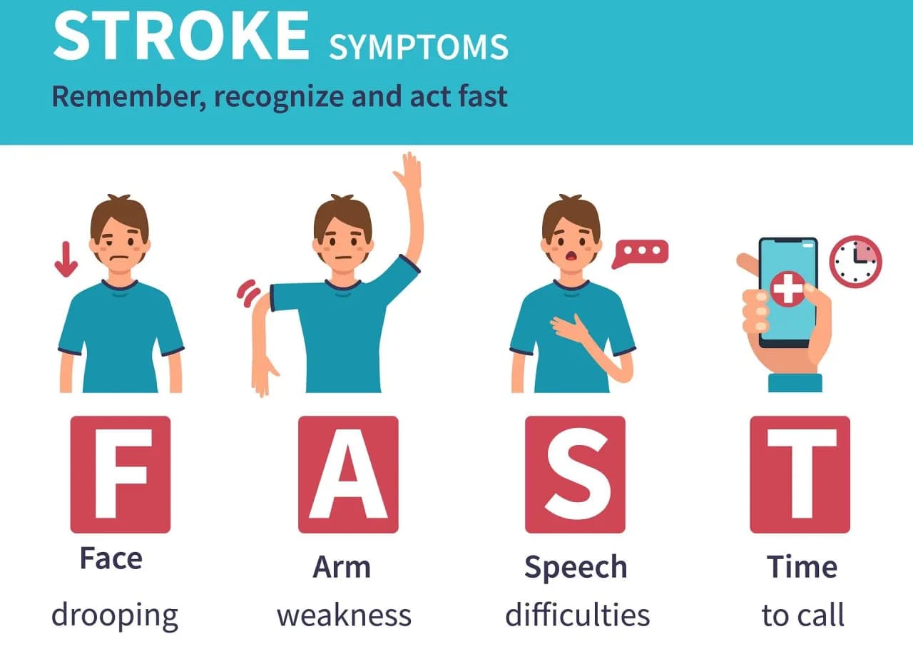 Początki udaru objawy – jak je rozpoznać i nie przegapić reakcji Początki udaru objawy – jak je rozpoznać i nie przegapić reakcji