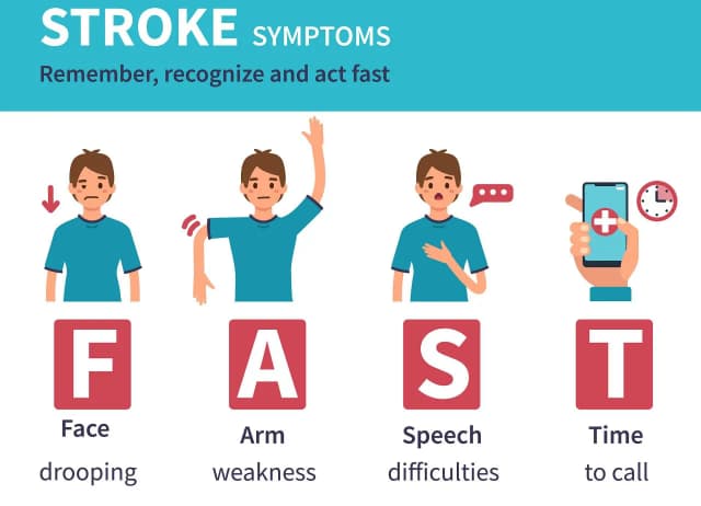 Początki udaru objawy – jak je rozpoznać i nie przegapić reakcji Początki udaru objawy – jak je rozpoznać i nie przegapić reakcji